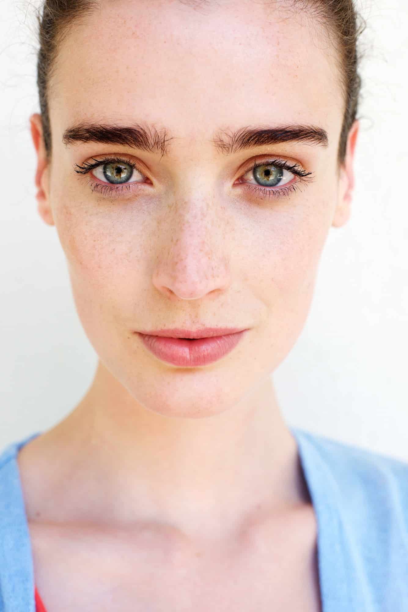 Healthy woman with freckles