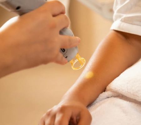 epilation-laser-melticolor