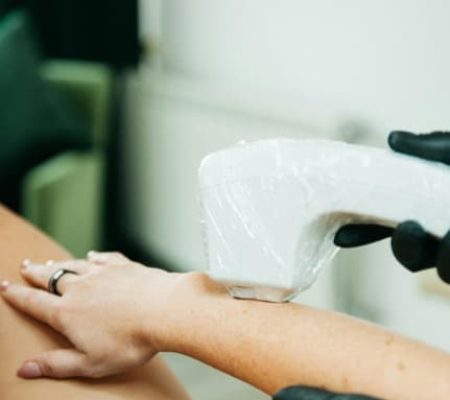 epilation-laser-villeurbanne